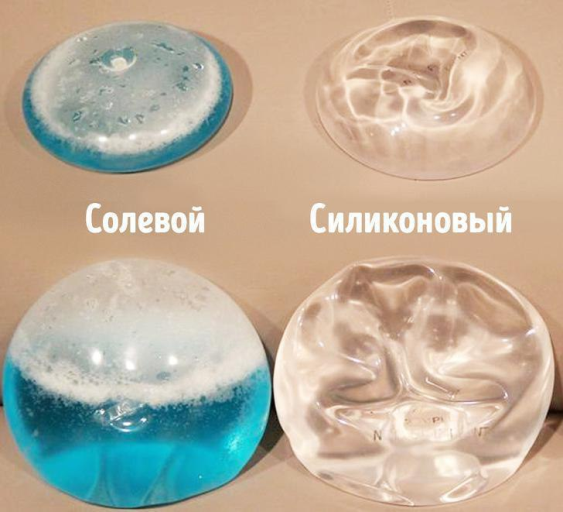 getrelaxme's tweet photo. В 2010г. в американку Лидию Карранс стреляли из пистолета, солевой раствор в импланте остановил пулю и спас жизнь. Ученые выяснили, что солевой имплант способен замедлить пулю на 20%, а силиконовый  на 31%. 
#селикон #импланты #спасит��жизнь 
Остальное на https://t.co/ivUKqMq6JE https://t.co/Ic7R1dhWDu