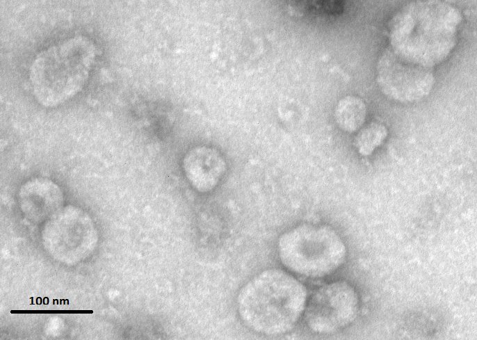 CSIC's tweet photo. Un nuevo método detecta nanovesículas en cantidades mínimas de orina, para poder obtener información de éstas (que informan sobre el estado de salud del organismo). El método es trasladable a la práctica clínica y no es invasivo para el paciente.@CNB_CSIC 
https://t.co/LAsMJ4Ylsr https://t.co/fldKFbdnBQ