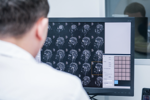 TryMunity's tweet image. How Is a Traumatic Brain Injury Diagnosed? bit.ly/2EaQh5p