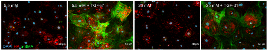 musclecellnews's tweet photo. @HHU_de Cardiac researchers looked at fibroblast activation and hyaluronan synthesis in response to hyperglycemia and diet-induced insulin resistance https://t.co/rrjWorT0Lo https://t.co/nfXsvhrSsr