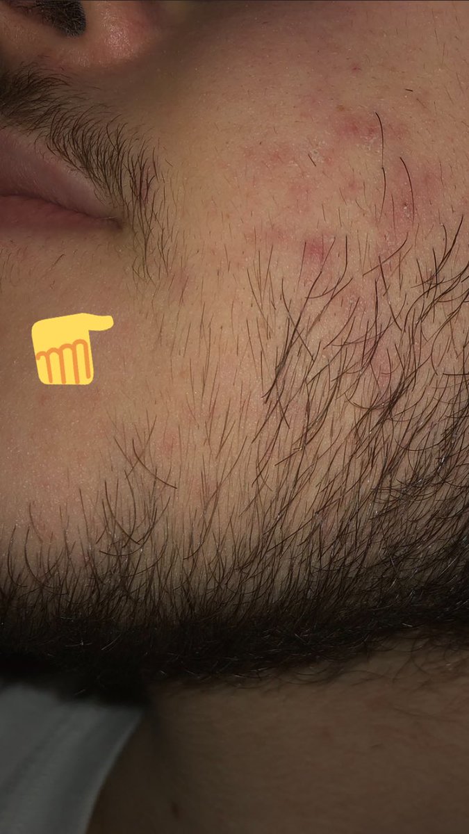 LOOK AT THOSE HAIRS SLOWLY CONNECTING TO MY BEARD!! MY CHILDren KEEP GROWING YOU’RE DOING AMAZING