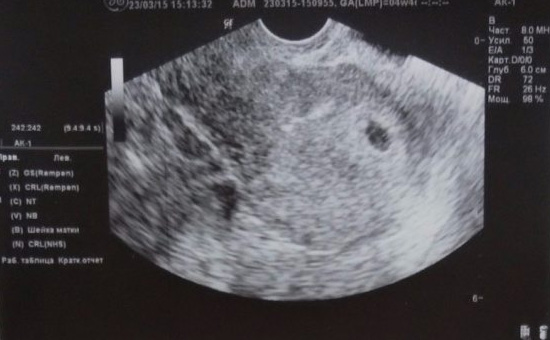 DRJDBleu's tweet photo. Well... this just happened... 🍼 https://t.co/wgRvdlgSB1