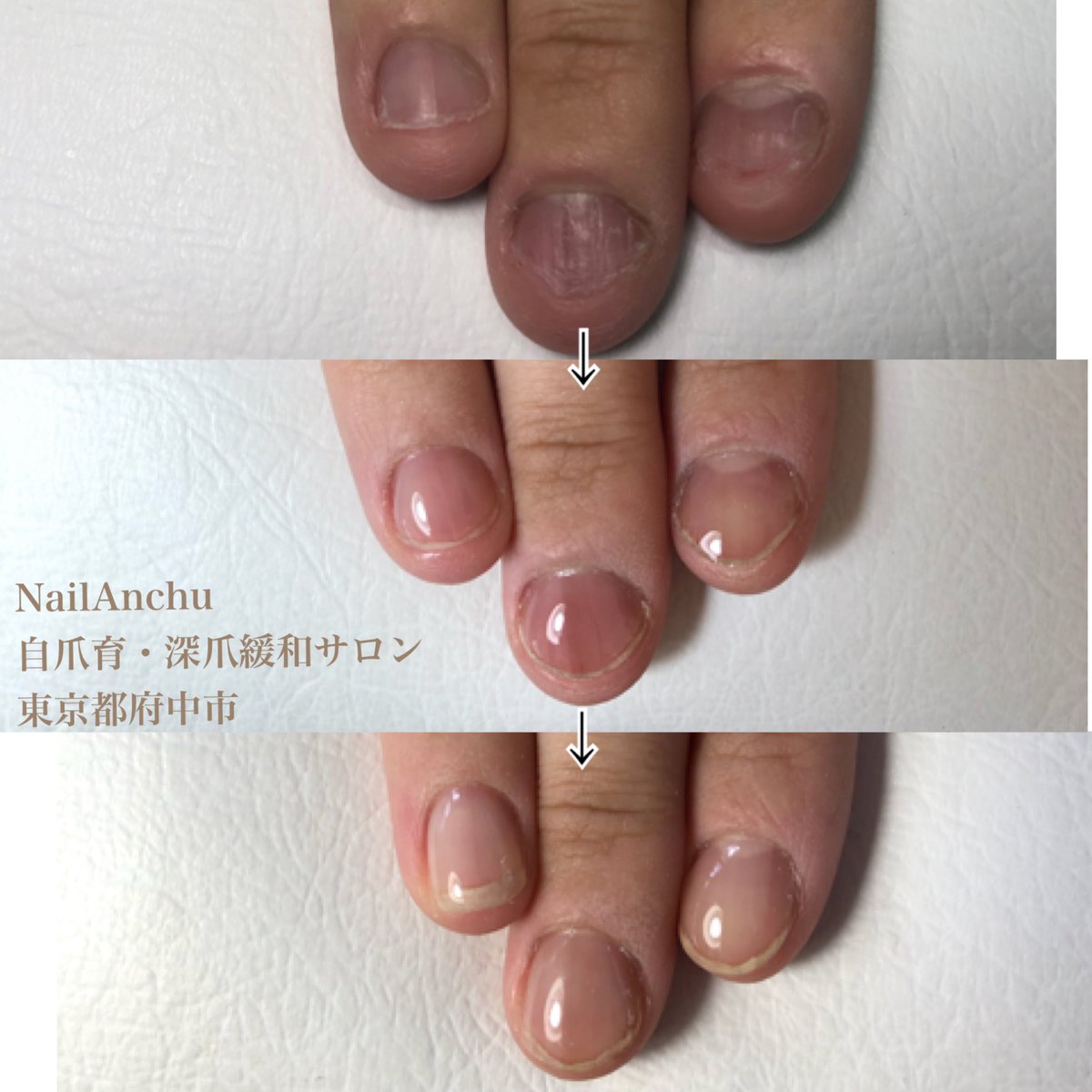 自爪育成サロンnail Anchu 東京都府中市若松町 Anchunail Twitter 自爪育成サロンnail Anchu 東京都府中市若松町 Anchunail Twitter