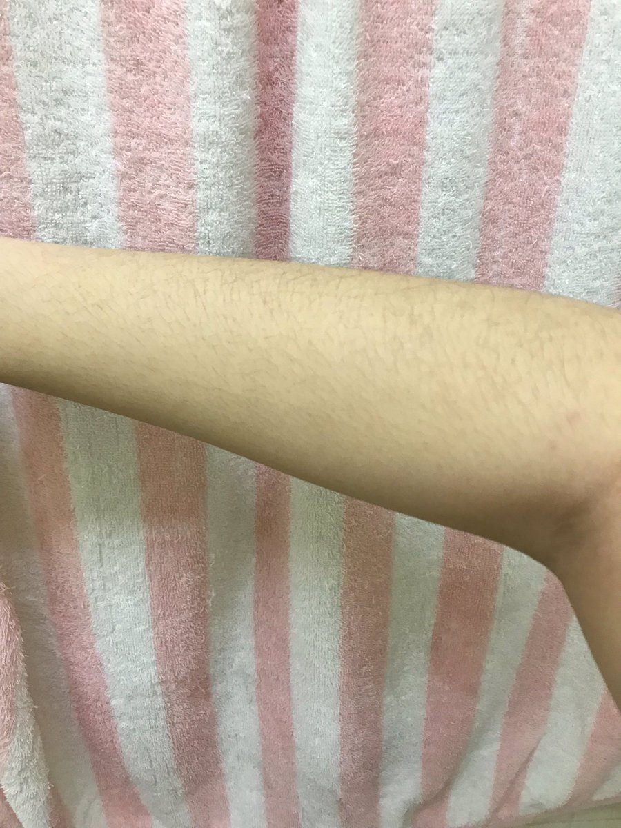 reviewmaleaw's tweet photo. plu body scrub เราไปลองซื้อมาใช้เพราะเห็นรีวิวว่ามันดีพอลองใช้เเล้วคว��มรู้สึกหลังใช้ดีนะรู้สึกผิวสะอาดเเล้วก็นิ่มขึ้นเเต่ไม่ได้ดีเท่าที่เค้าโฆษณาไว้ สำหรับเราคิดว่าถ้าหมดก็อาจจะซื้อใช้ต่อ (ในรูปหลังใช้กล้องสว่างกว่ารูปก่อนใช้จึงทำให้สีผิวดูขาวขึ้นมากกกก)#ไว้รีวิวห้ามขายของโว้ย https://t.co/arz6OAPJa0