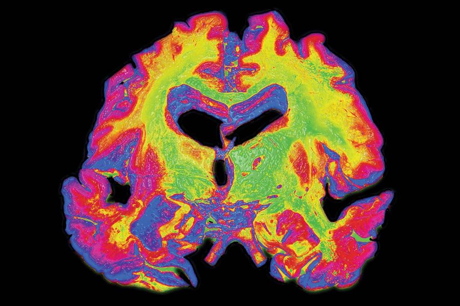 Could amyloid diversity explain drug failures in #Alzheimers disease? Read why in our February issue doi.org/10.1038/s41587…