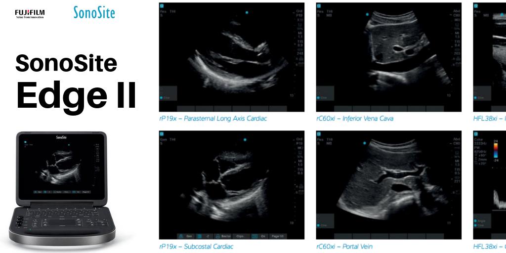 Sonosite's tweet photo. In the #acutecare environment, reducing the time to make an accurate diagnosis is a critical need. The SonoSite Edge II features DirectClear Technology, elevating transducer performance by increasing penetration and contrast resolution https://t.co/DlDojts5i1 #POCUS #EMED https://t.co/75gICnLrPH