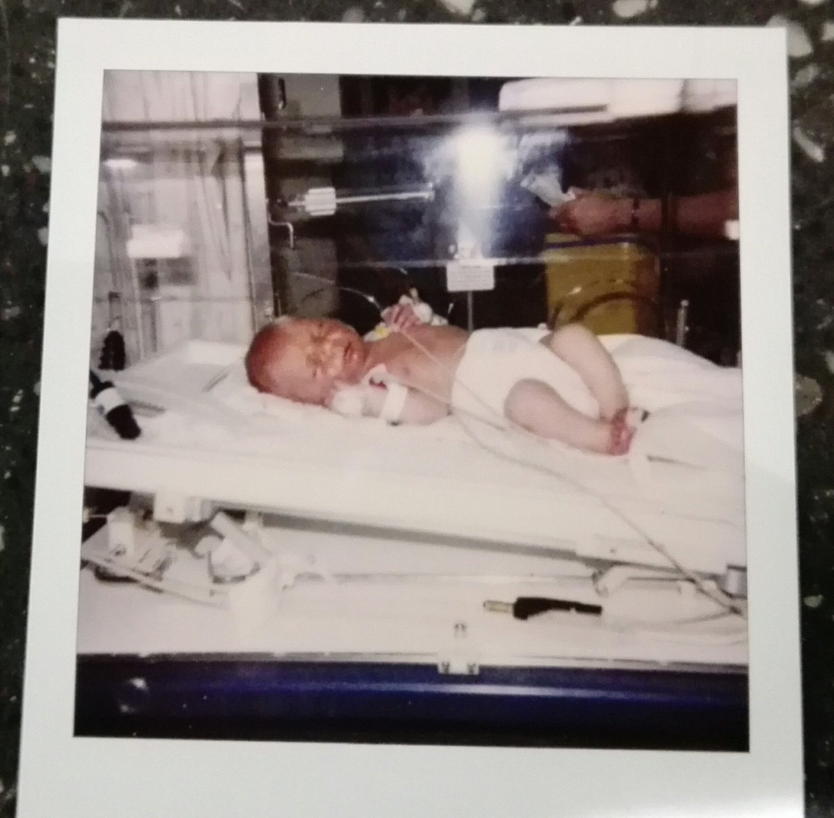 DavidSBingham's tweet photo. @Chldns_Hrtbeat What a difference 21 years make! James Bingham 21 today #RockRedFriday 💖 https://t.co/QeAZ41zrg0