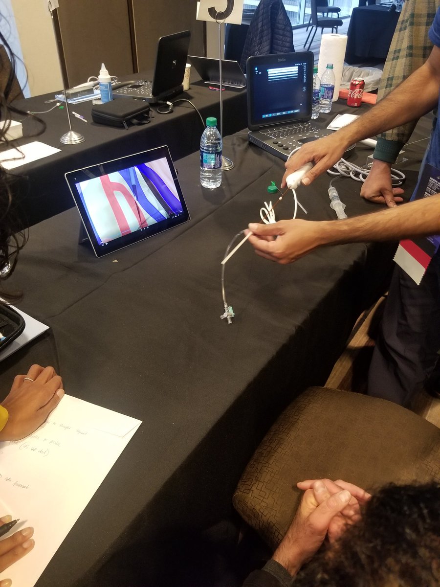 Seeing the Ellipsys system in demonstration. #EndovascularAVFCreation @RenalFellowNtwk @ASDINNews @NSMCInternship #ASDINInATL