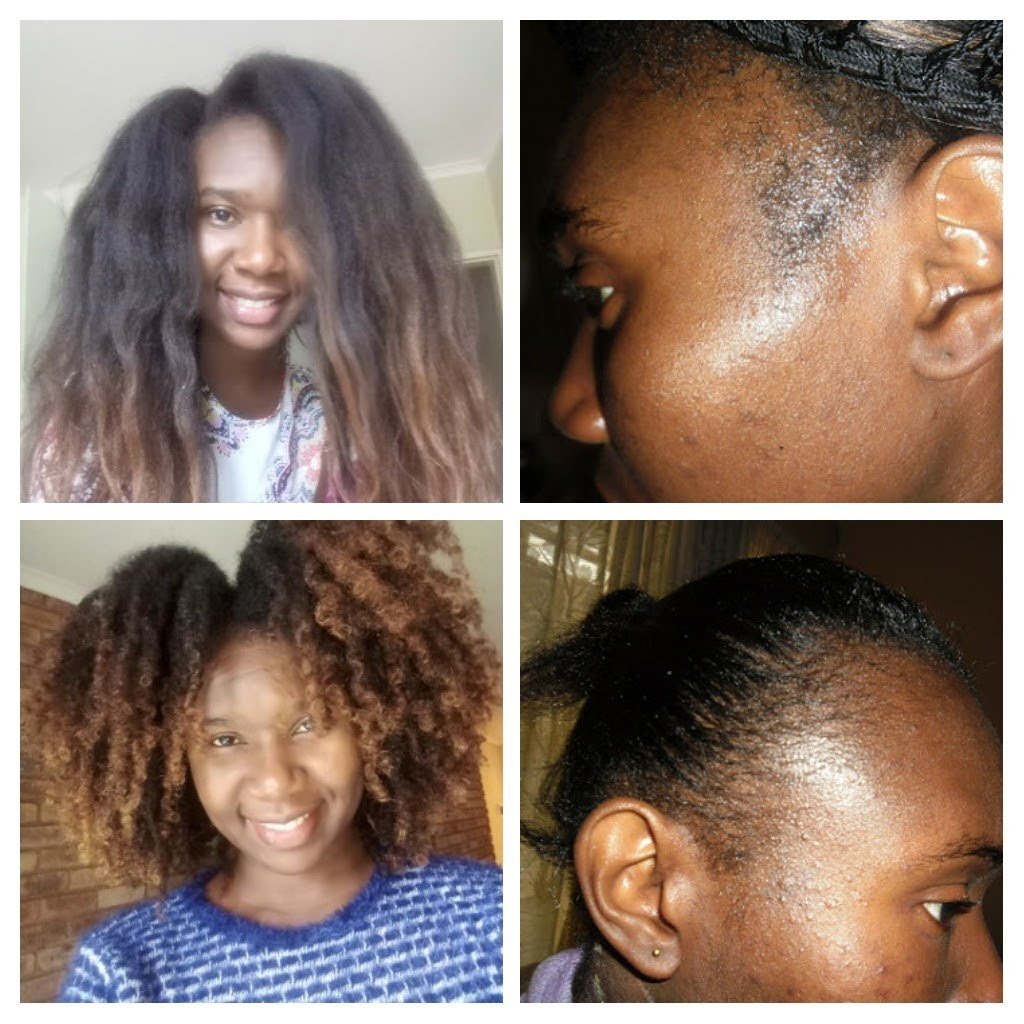 NaturallyCurl17's tweet photo. Hair evolution #hairloss #hairstyle #curlyhair #longhair https://t.co/ACnnP6mTp5