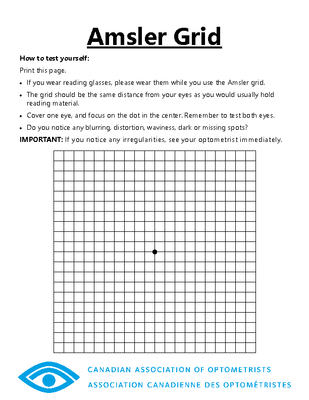 Canadian Association of Optometrists on X: Early signs of  #maculardegeneration can include waviness, distortion, blurring or missing  areas on the Amsler grid. These changes may indicate a problem or worsening  of #AMD.