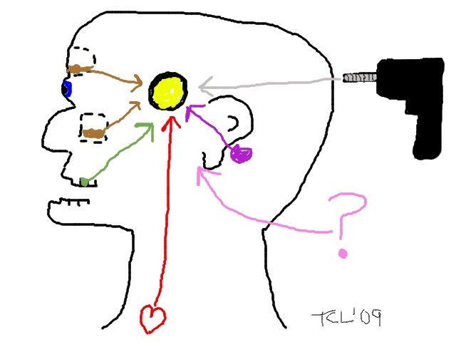 DrToddLee's tweet image. Here is a something I drew when we were fellows together professor. How do patients get brain abscess? #frcpc