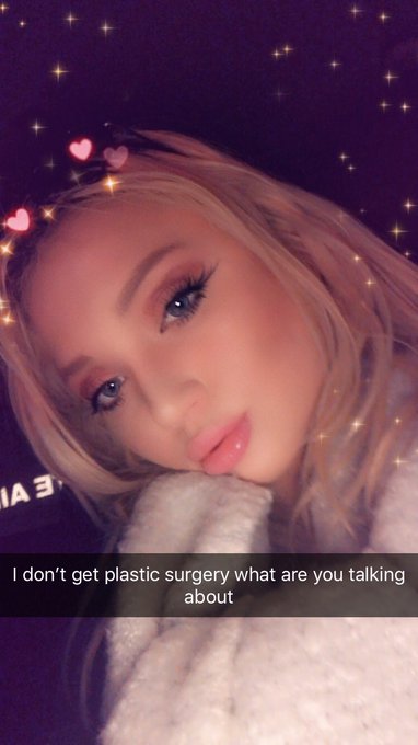 Sorry not sorry my botox and filler doctor is on point https://t.co/irLT4eTlkA<a href="/tag/chaturbate"class="tags"><span>#chaturbate</span></a>