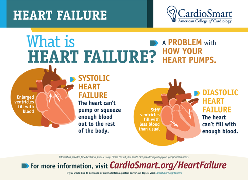 CardioSmart's tweet photo. If you have #heartfailure, your heart isn’t pumping as well as it should. Learn more about HF w/ CardioSmart's condition center: https://t.co/x4Hudot3Hm #HFWeek2019 https://t.co/cBGTsrA9Fp