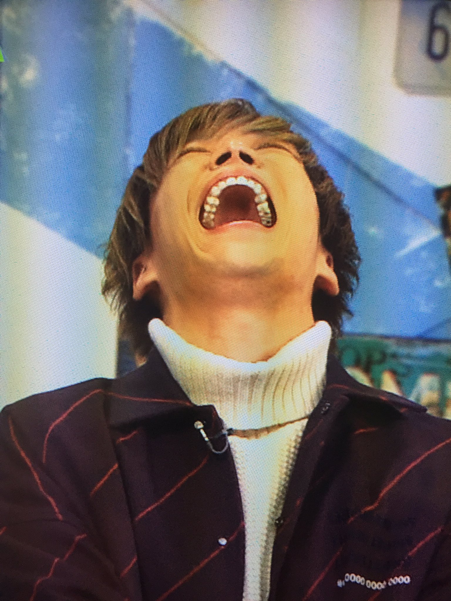 טוויטר キスマイ歯担 清少納言 בטוויטר 千賀健永くん やっぱ左上奥歯 虫歯だよね この黒さは怪しい萌えるな 千賀健永 歯フェチ T Co Kxkdjeguiv