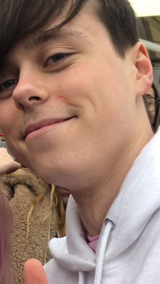 justanzia's tweet photo. Is it just me or is @ImAllexx face the same in every picture from vidcon aka #beancon and also did you cut yourself while shaving @ImAllexx https://t.co/OqjwFCKcLh