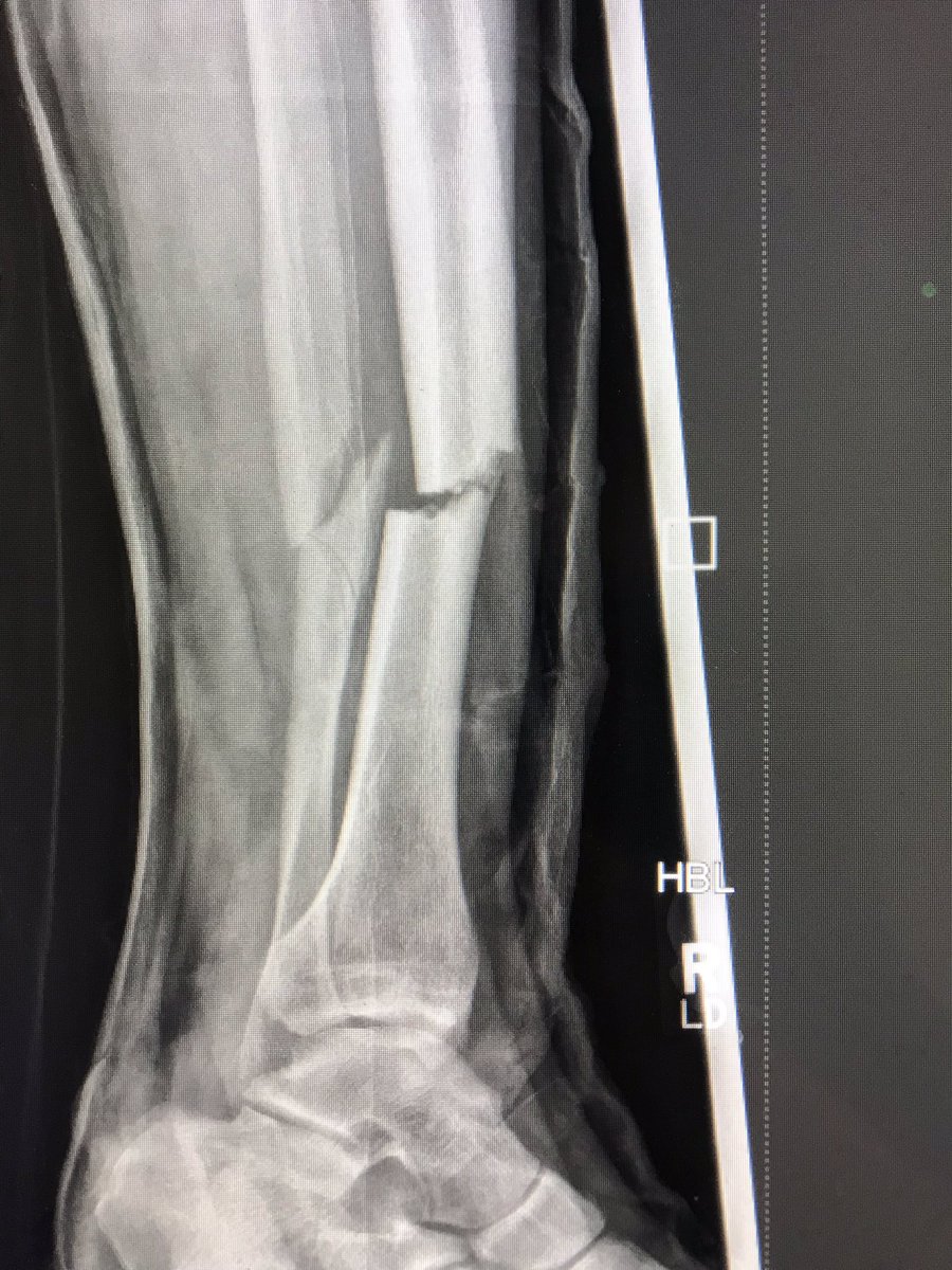 Kris Too Far tweet media