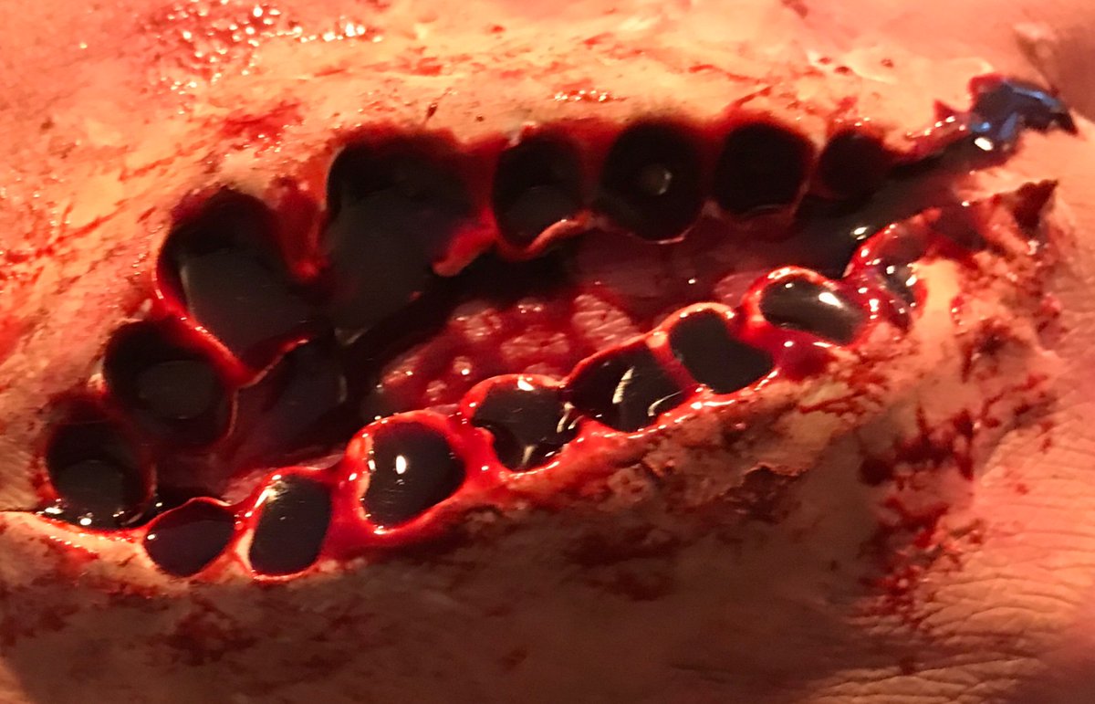 FirstOnScene2's tweet image. It’s always best to prepare course participants for anything and everything 

#biteinjury #sfx #firstaid #FIRSTRESPONDERS