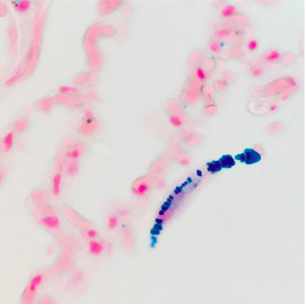 What Is Spindle Cell Cancer In Dogs