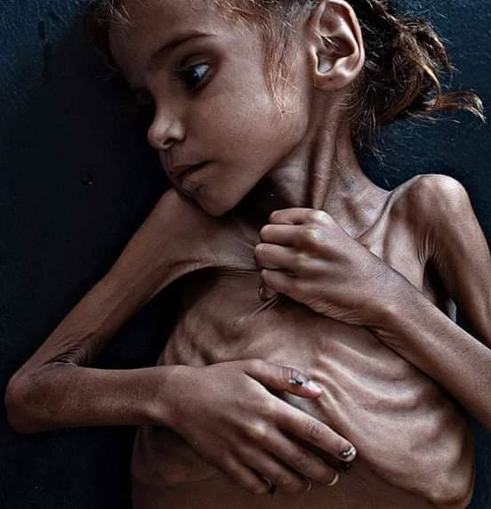 Sagopaak's tweet photo. Today, Barbarian & Murderer of innocent Yemenis are coming to Pakistan to make lucrative investment agreements.
I protest against his visit.
#PakistanRejectMbs
#MbSNotWelcome
#Pak🇵🇰#KSA🇸🇦
#CrownPrinceinPakistan
#PakSaudiFriendship
#PakSaudiCulturalBonds
#PakSaudiBrotherhood https://t.co/v3f0D4wMzz