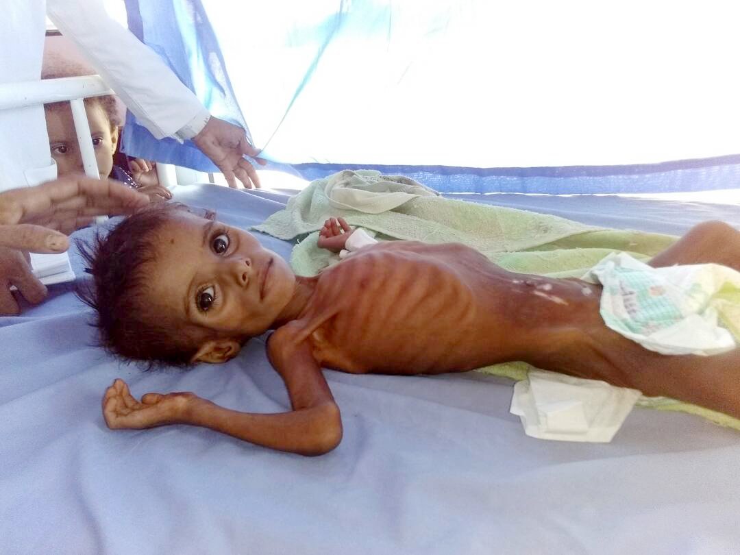 Sagopaak's tweet photo. Today, Barbarian & Murderer of innocent Yemenis are coming to Pakistan to make lucrative investment agreements.
I protest against his visit.
#PakistanRejectMbs
#MbSNotWelcome
#Pak🇵🇰#KSA🇸🇦
#CrownPrinceinPakistan
#PakSaudiFriendship
#PakSaudiCulturalBonds
#PakSaudiBrotherhood https://t.co/v3f0D4wMzz