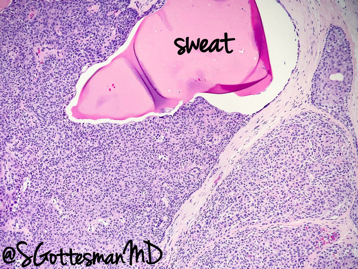 Silvija Gottesman MD tweet media