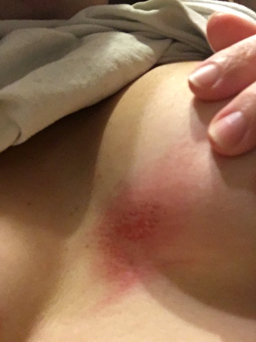 When you start back to ride a motocross but your body is shit. I need somebody to put some cream on me<a href="/tag/mvsales"class="tags"><span>#mvsales</span></a>