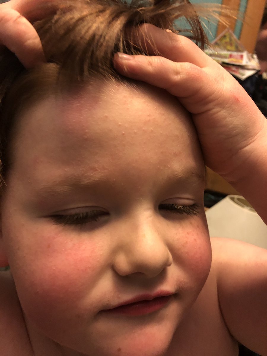lifewithclark's tweet photo. We had a near catastrophe because of this kid’s stubborn streak. He knocked a 27” TUBE tv off the top of the dresser because he wanted to put something else up there. Thankful it only hit his head 😳😬 https://t.co/7UOBHrREk9