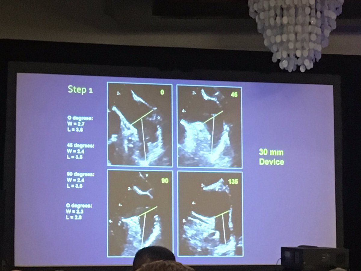 📷: Sizing the Watchman: Great talk on the LA occluders by @renujain19 at SOTA! And a great reference slide for how to measure depth on these complex structures  @ASE360 #echosota