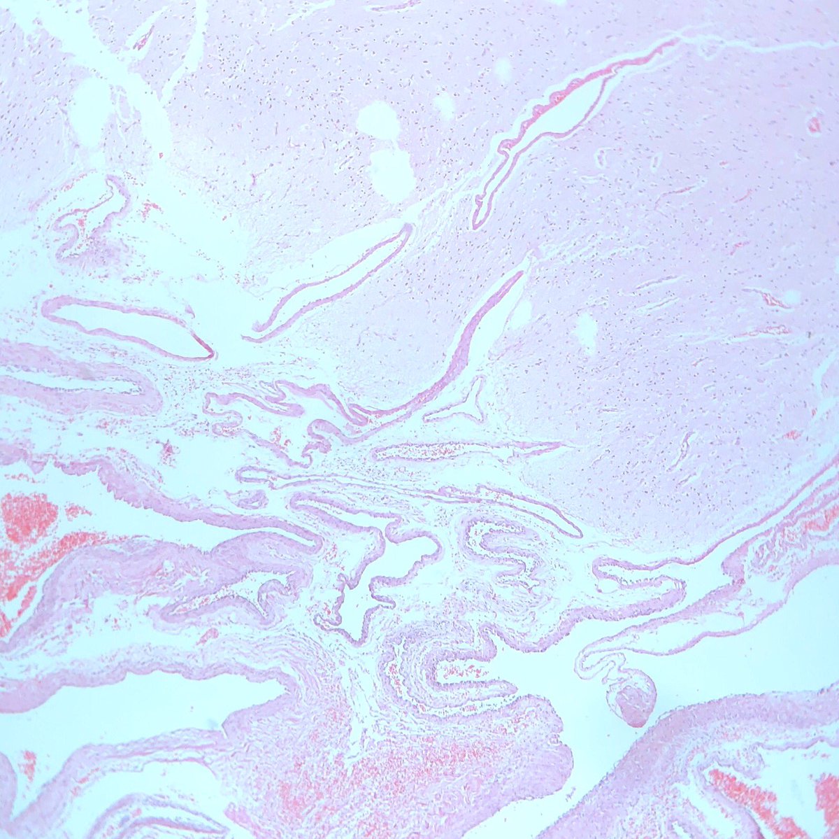 view clinical and experimental pathology of lung cancer 1985