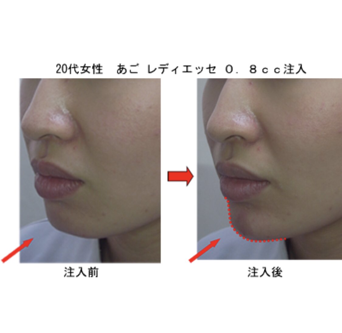 レディエッセ Twitter Search Twitter