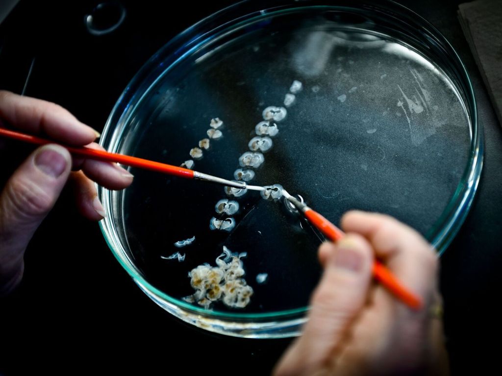 Innovation2's tweet photo. The promise of stem cell technologies for treating Parkinson’s #stemcelltechnologies #Parkinsons #stemcelltreatment #WeillCornell #sloan_kettering #lunduniversity https://t.co/C2AR1peoVt https://t.co/fzBPokgCZX