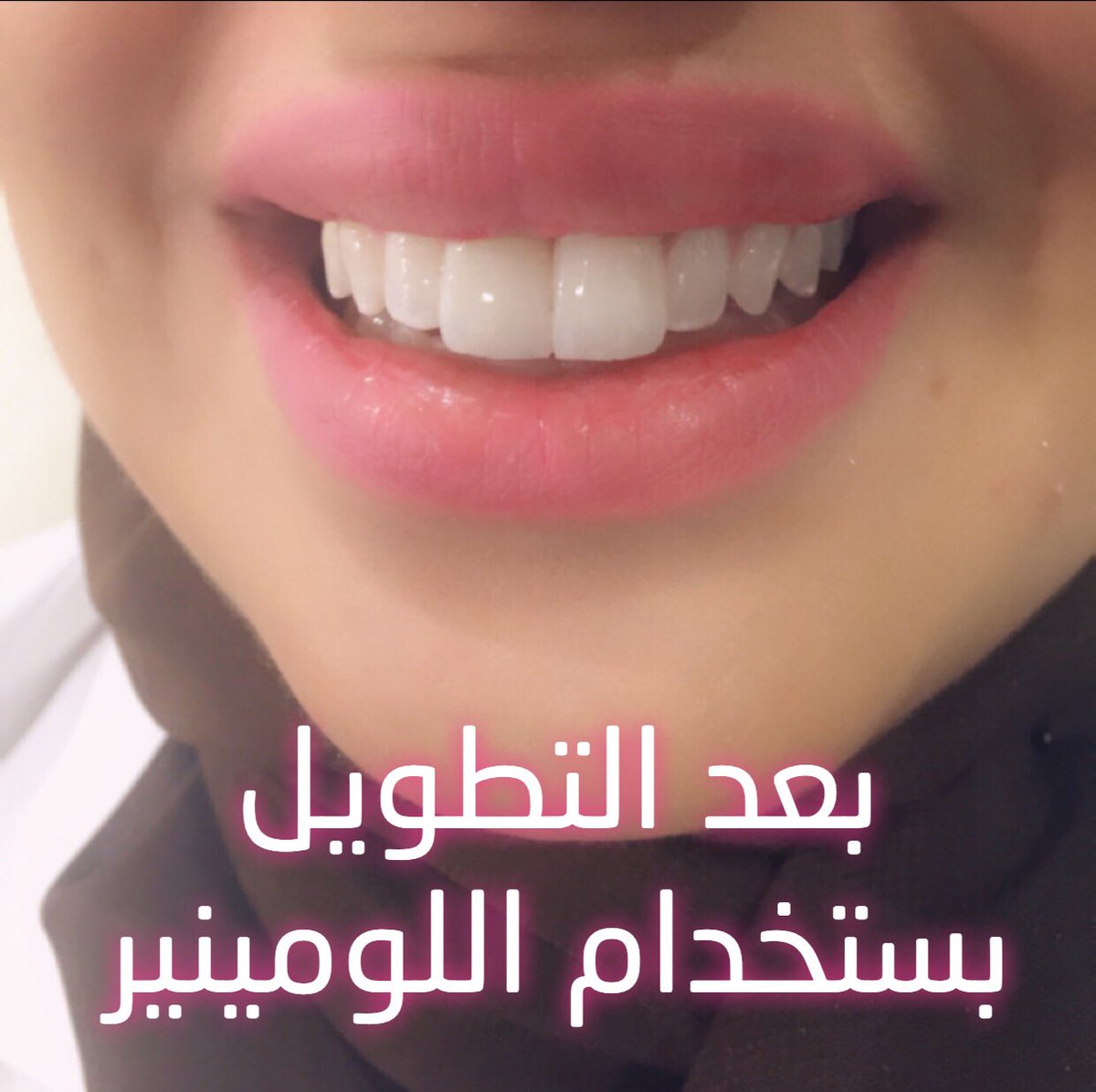 Haischlib اللومينير Ar Twitter