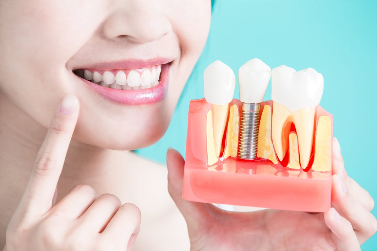 Dental Implants Will Give You Something to Smile About....

They say that a smile can change the world around you. A smile is enough to resolve a dispute, start a friendship, and even show affection to your loved ones. 
Dental implants are....... search.google.com/local/posts?q=…