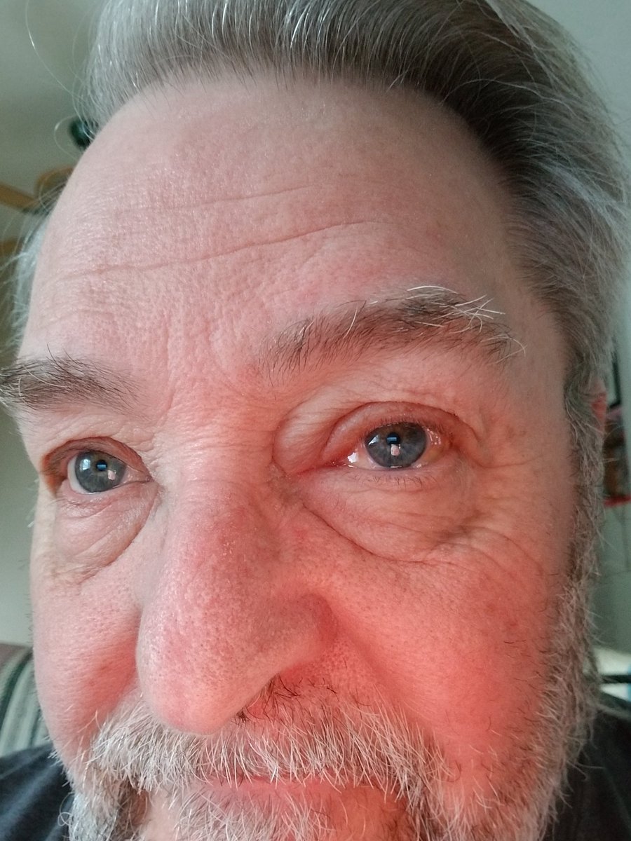 autoclear's tweet image. I must have gotten bit by something. I itch allover.  I took an allergy pill and it is starting to calm down.   All is well now