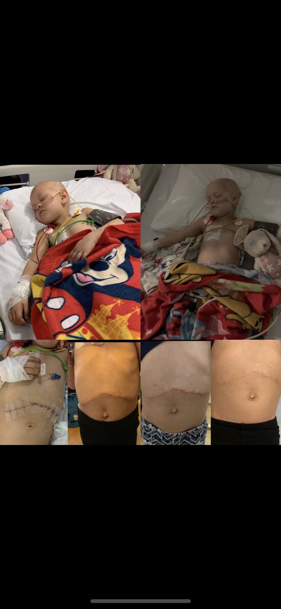 Caylasfight's tweet photo. Last Thursday we had the best ever news! Cayla is in REMISSION 🎉😍 we are so proud of how far she has come! Cayla has done her part and beat this horrible disease, &amp; now we need to step up and get her the the USA for the vaccine to ensure that she never goes through this again! https://t.co/iqMZY7wvxm