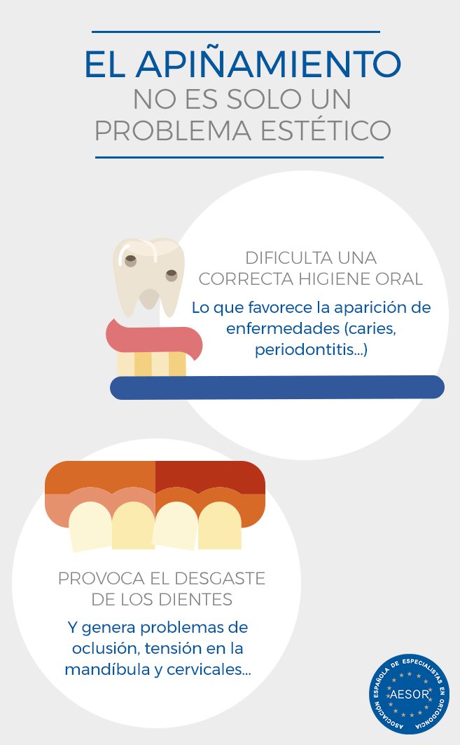 El apiñamiento es uno de los problemas dentales más frecuentes y al que, en ocasiones, no se le da la importancia que le corresponde. El tratamiento con #ortodoncia consigue corregir esta malposición dental.
