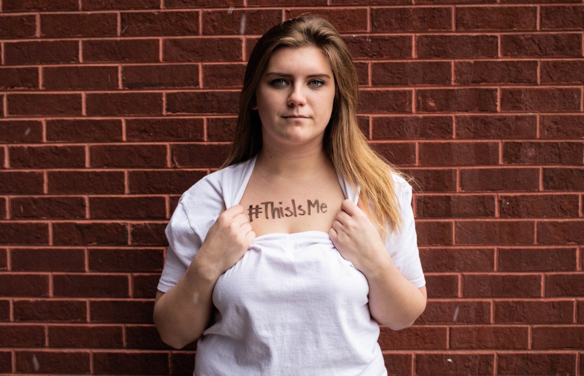 DPhiE_SIUE's tweet photo. Today kicks off the first day of ANAD (Anorexia Nervosa and Associated Disorders) Week!! Today we ask all of you to participate in #MakeuplessMonday. Upload your makeup less selfie and tag us! https://t.co/i6a7vIvemU