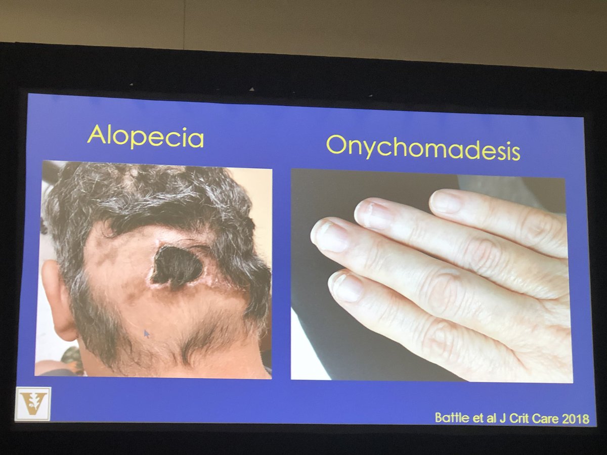 iamyourgasman's tweet photo. Shout out to @ceribattle and her excellent allopecia study via @wicsarg from @ICU_Recovery #THRIVEICU #CCC48 https://t.co/gLi6gqglFr https://t.co/XC7r44IOlg