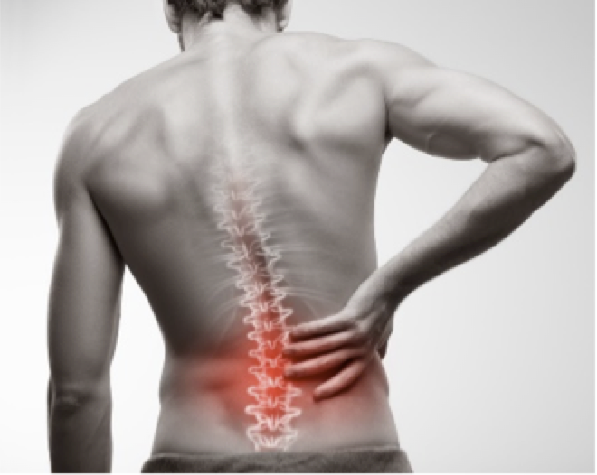 SDSMPilates's tweet photo. “STAR Study” is a research study for patients with sudden onset of #BackPain due to #MuscleSpasm enrolling at SDSM. Contact our SDSM medical office today at 619-229-3909 to hear more about this new investigational (#nonopiate) drug treatment. https://t.co/MsqqIlO2hG