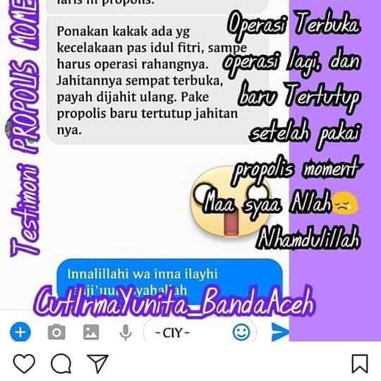dianastuti86's tweet photo. Mungkin anda atau orang disekitar anda punya kasus yang serupa dengan difoto-foto ini, tidak ada salahnya lakukan ikhtiar yang sama 🤗🤗🤗

Cek yuk fotonya 👇👇👇

Info lebih lanjut 👇

Sms/Tlp/wa 081288514757 https://t.co/1OYeoPpQUL
