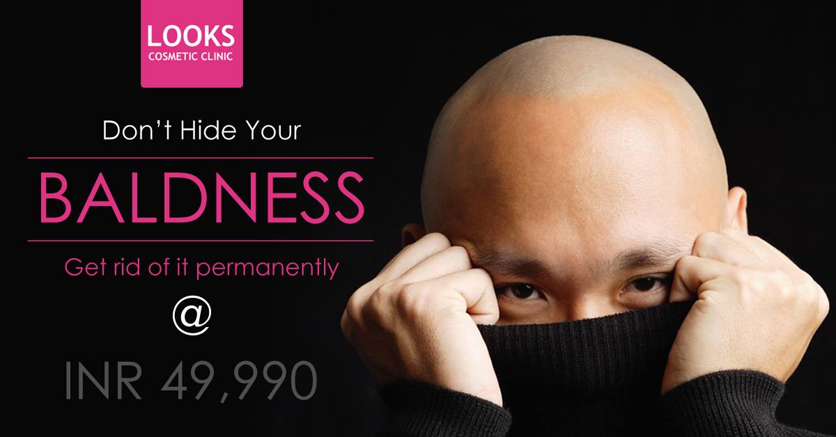 Get rid of #Baldness #Permanently Now @49,990, No #Cut or #Scar, Biotech #Hair #Transplant #Method, #Dense & #Natural #Result, Free #Scalp #Assessment & #Consultation, Book #Appointment Today @8828126315