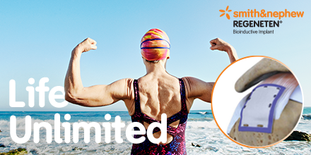 smithnephew's tweet photo. Will you be joining us at #AAOS2019? If you need more information on bioinductive implants for shoulder arthroscopy in the #CountdownToAAOS, read this #REGENETEN evidence https://t.co/y0lqhGigKp https://t.co/qiHPWhKhSC