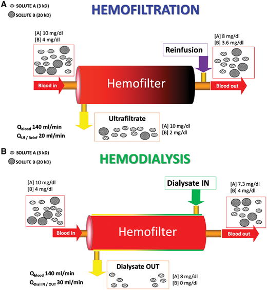 NDTsocial's tweet photo. Acute kidney injury: to dialyse or to filter? https://t.co/llnErYLXpQ @RicciZaccaria #hemodialysis #hemofiltration #AKI https://t.co/6xwSgljij3