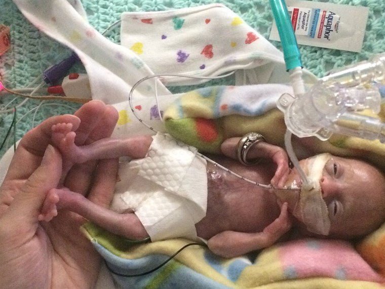 Lyla Strensrud was born at 21.4 weeks and weighed 14.4 oz in 2014. https://www.today.com/health/born-21-weeks-she-may-be-most-premature-surviving-baby-t118610