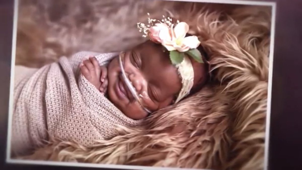 Dakota Smith was also born at 21 weeks 2017. (Her daddy is J.R. Smith who plays for the Cleveland Cavaliers). https://www.washingtonpost.com/news/early-lead/wp/2017/05/23/j-r-smith-finally-able-to-bring-prematurely-born-daughter-home-from-hospital/?noredirect=on&utm_term=.01fa78d8d738