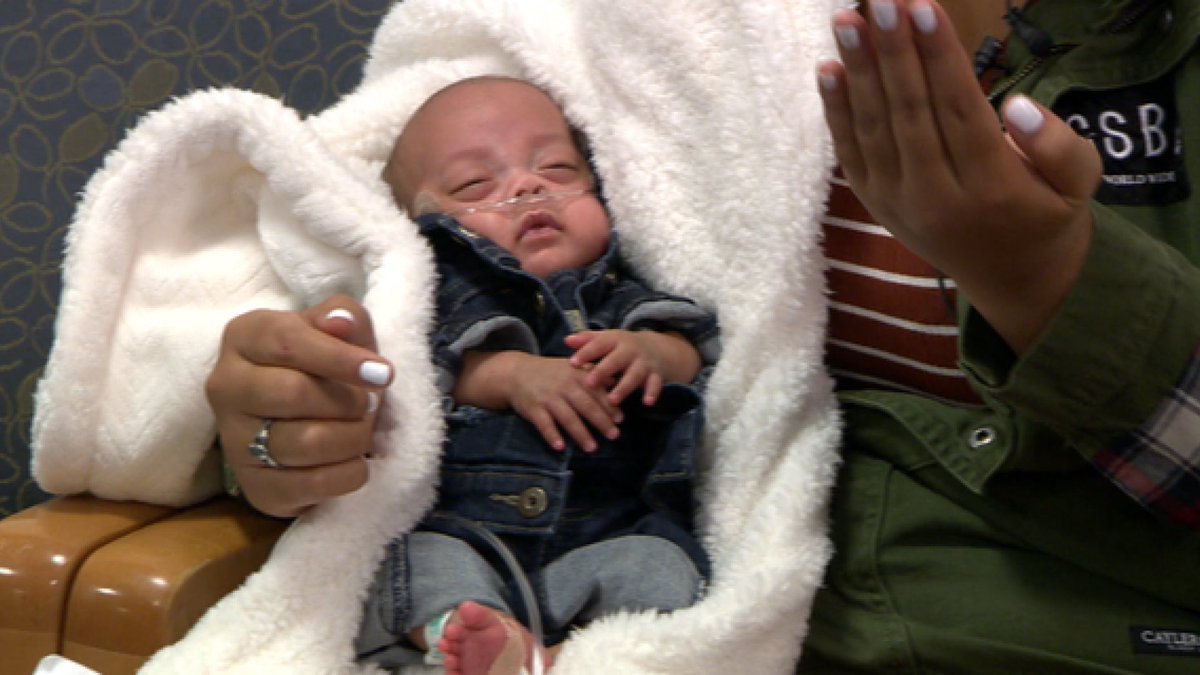 Leni was only 22 weeks and barely over a pound when he was born at home. He was resuscitated by firefighters.  https://gooddaysacramento.cbslocal.com/2018/11/28/nicu-survival-giving-back/