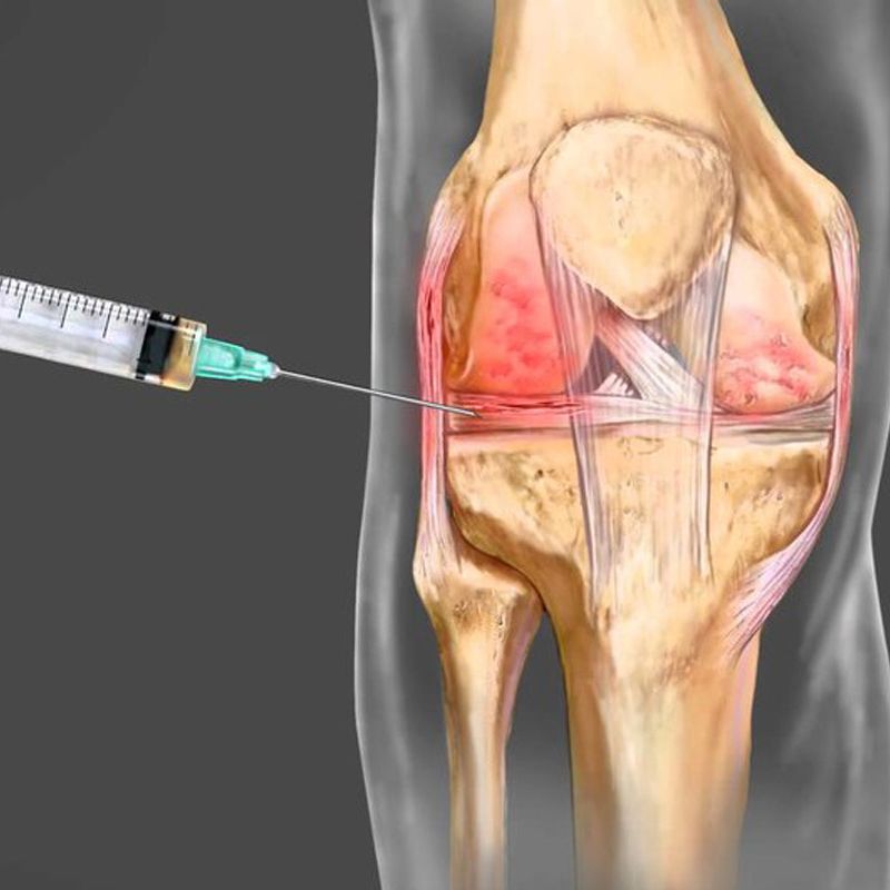 genlifemed's tweet photo. Suffering From Knee Pain ? - #prolotherapy #kneepain #jointpain #genliferegenerativemedicine #healing #miamidoctor #alternativemedicine
Find Out More https://t.co/uZLMRLjTk5 https://t.co/XrNXZ9ZVBa