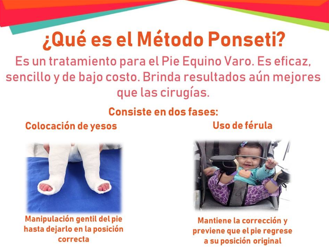 OrtoKalach's tweet image. ¿Has oído hablar del Método Ponseti?
Es un tratamiento eficaz, sencillo y poco invasivo para tratar el Pie Equino Varo.
Si tu bebé presenta esta condición, agenda una cita llamando al 5254-4836 y dale a tu hijo la atención que merece.
#ortopedia
#pediatrics