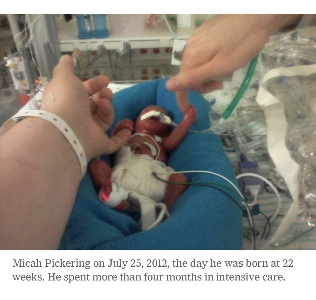 Micah Pickering was born at 22 weeks and 4 days.  https://www.newtondailynews.com/2015/05/15/2-year-old-newton-boy-gains-national-attention/ajwnlh9/?page=2