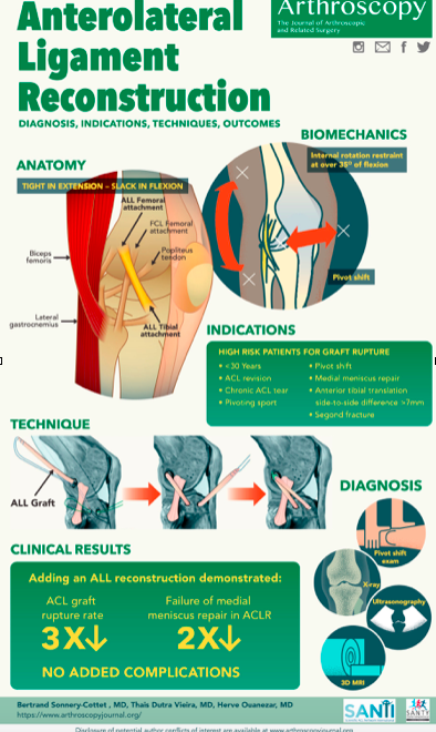 ArthroscopyJ's tweet photo. Anterolateral Ligament of the Knee: Diagnosis, Indications, Technique, Outcomes... as an infographic!!
https://t.co/zqCdEcD94W https://t.co/YO2rwcbHFn
